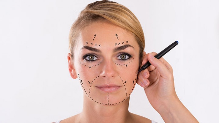 types-of-facelifts-woman