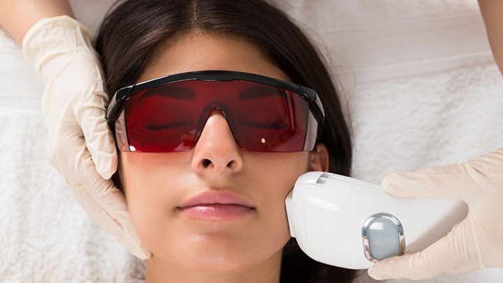 woman-receives-facial-laser-treatments